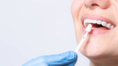 Dental-Implants